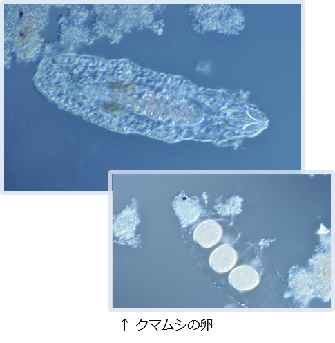 Macrobiotus ﾏｸﾛﾋﾞｵﾀｽ 排水処理が良好な時に見られる微生物 排水処理 水処理の大阪生物環境科学研究所